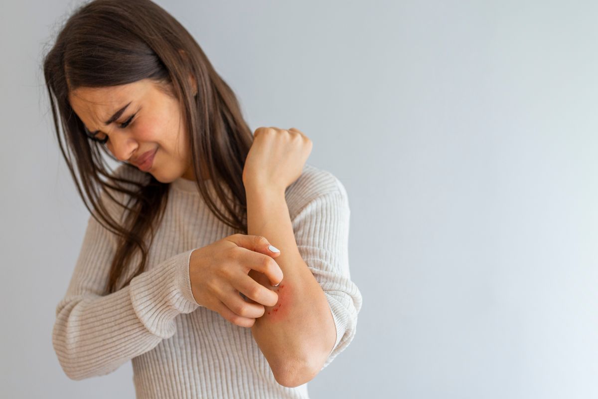 woman scratching arm because of eczema on skin