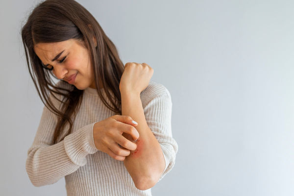 woman scratching arm because of eczema on skin